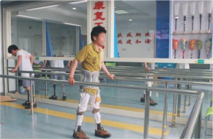 假肢產品價格表,安裝假肢價格貴不貴?(圖1) 假肢價格